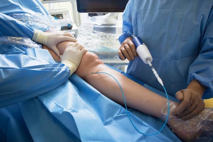Varicose Vein Which Doctor To See